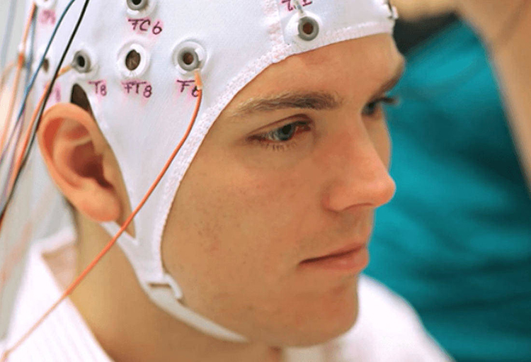 qEEG treatment display for ADHD